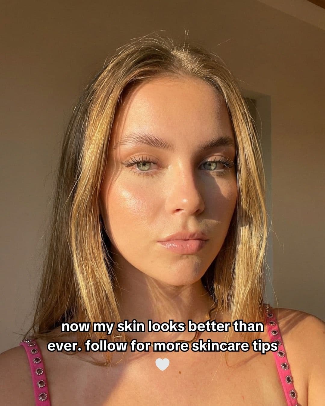 Slide four: a clear-skin selfie with text saying the creator's skin looks better and asking viewers to follow.
